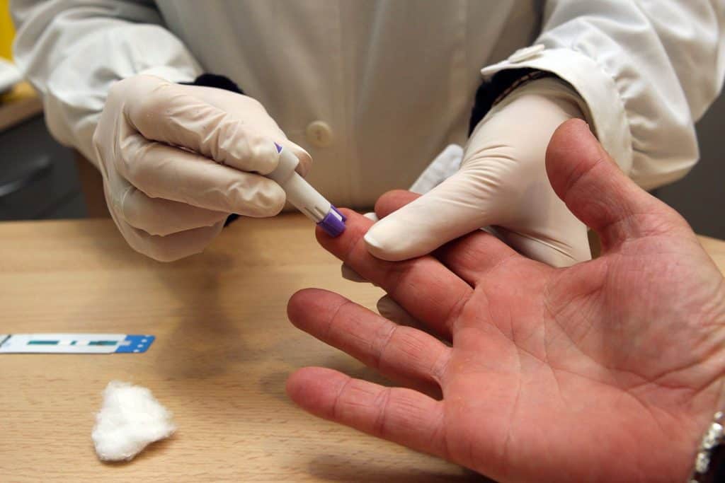 hiv test