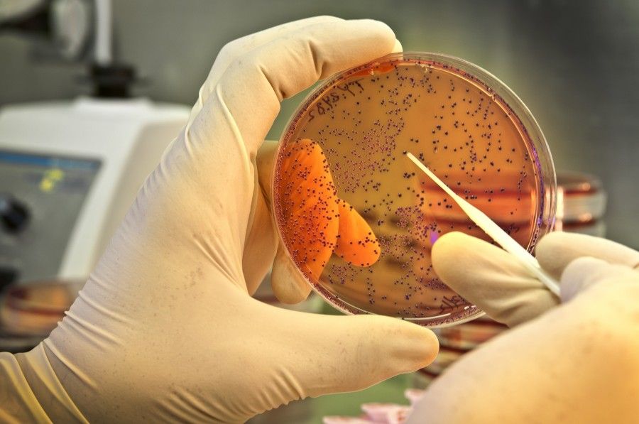 Alerta por un brote de Salmonella en Berazategui con 2 muertos por comer carne y derivados