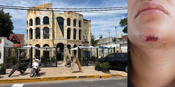 Brutal ataque en Ituzaingó: denuncian al dueño de un bar por fracturar a golpes a sus empleados