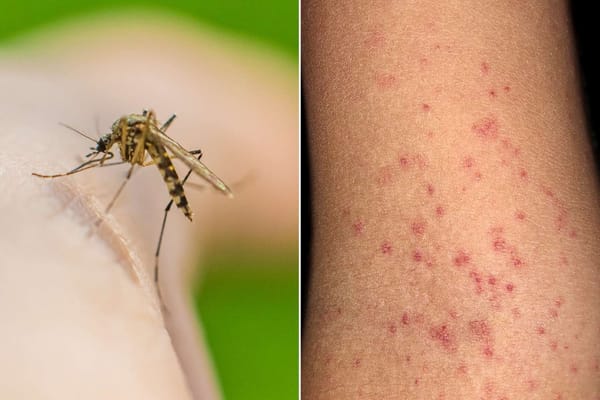 Morón refuerza las medidas de prevención y vacunación contra el dengue